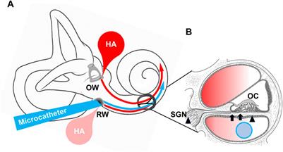 Editorial: Identifying novel drug delivery systems and treatments for hearing loss and related ear disorders, volume II